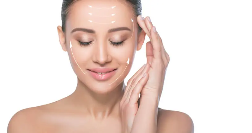Model with facial-treatment guide lines drawn on her face