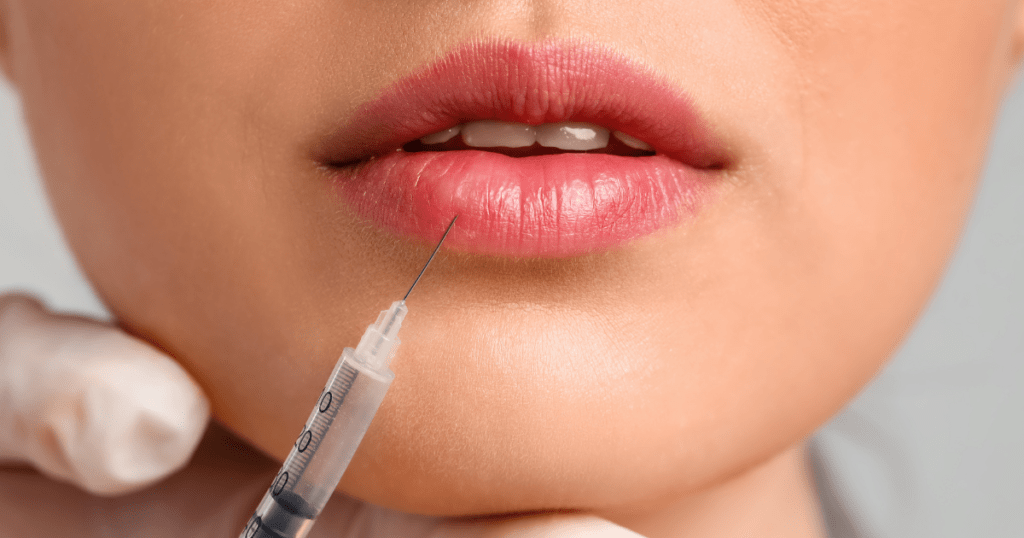 Lip Fillers Debunking Common Myths and Misconceptions | Anew Laser MD