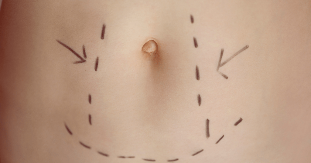 Areas That Can Be Treated | Anew Laser MD