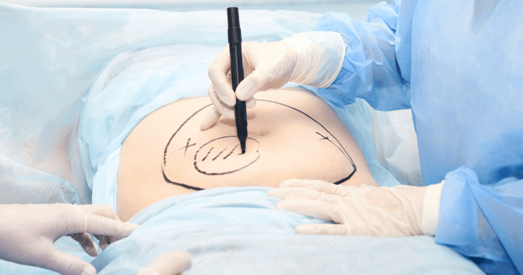 Choosing the Right Provider | Anew Laser MD