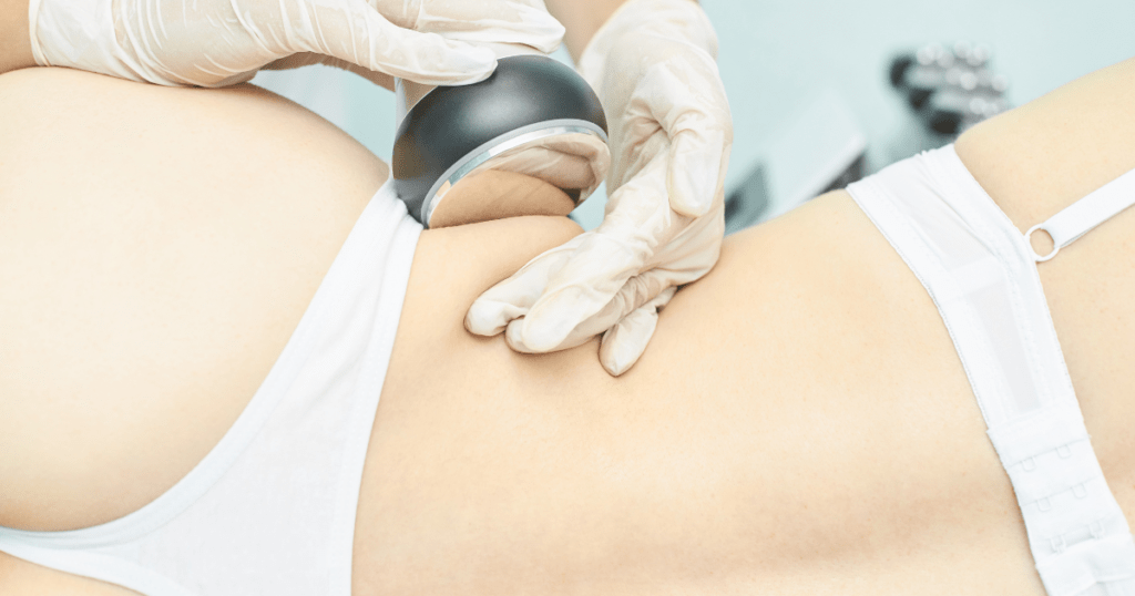 Benefits and Risks of Non-Surgical Body Sculpting | Anew Laser MD