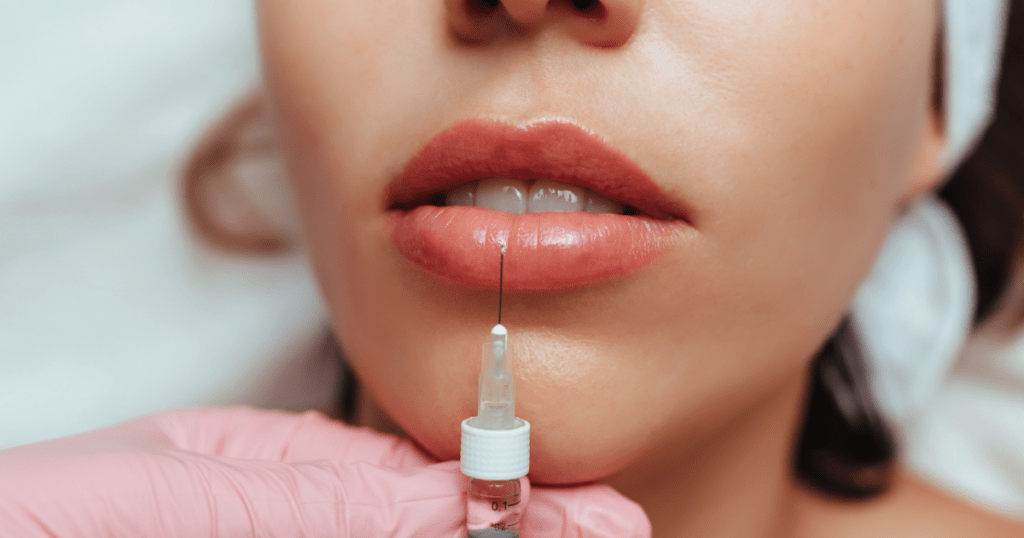 Pros and Cons of Lip Injections Is It the Right Choice for You | Anew Laser MD