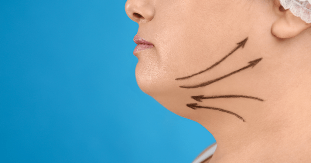 Kybella Injections A Comparison with Other Fat Reduction Treatments | Anew Laser MD