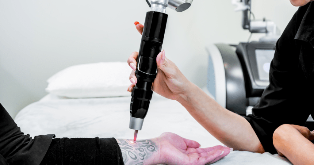 Laser Tattoo Removal Everything You Need to Know | Anew Laser MD