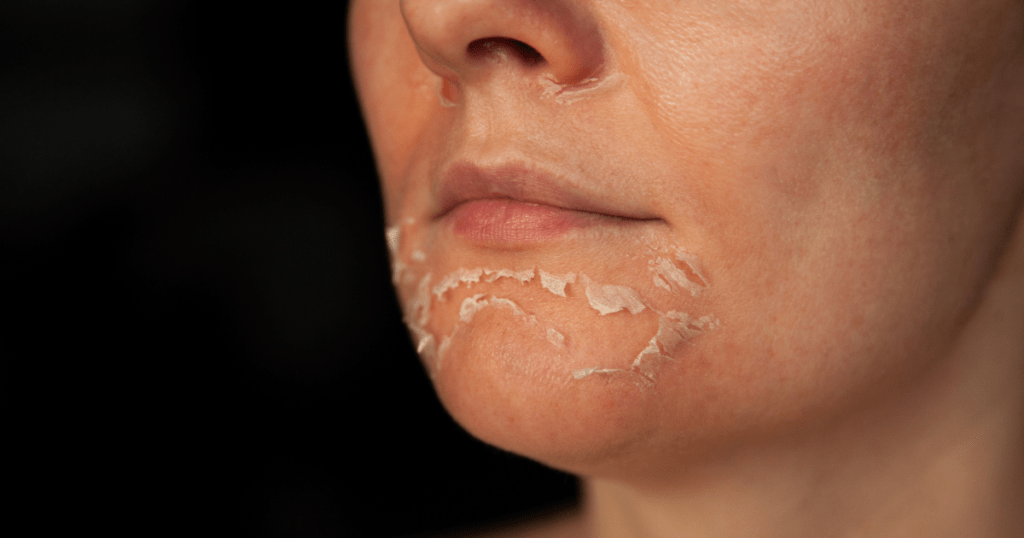 Potential Side Effects and Risks | Anew Laser MD