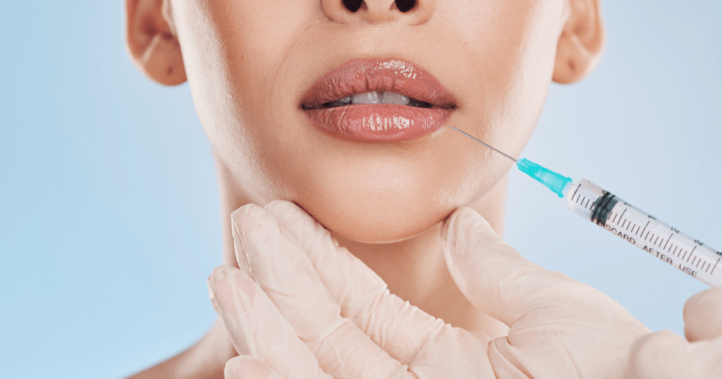 Understanding Lip Filler Side Effects A Guide to Post-Procedure Expectations | Anew Laser MD