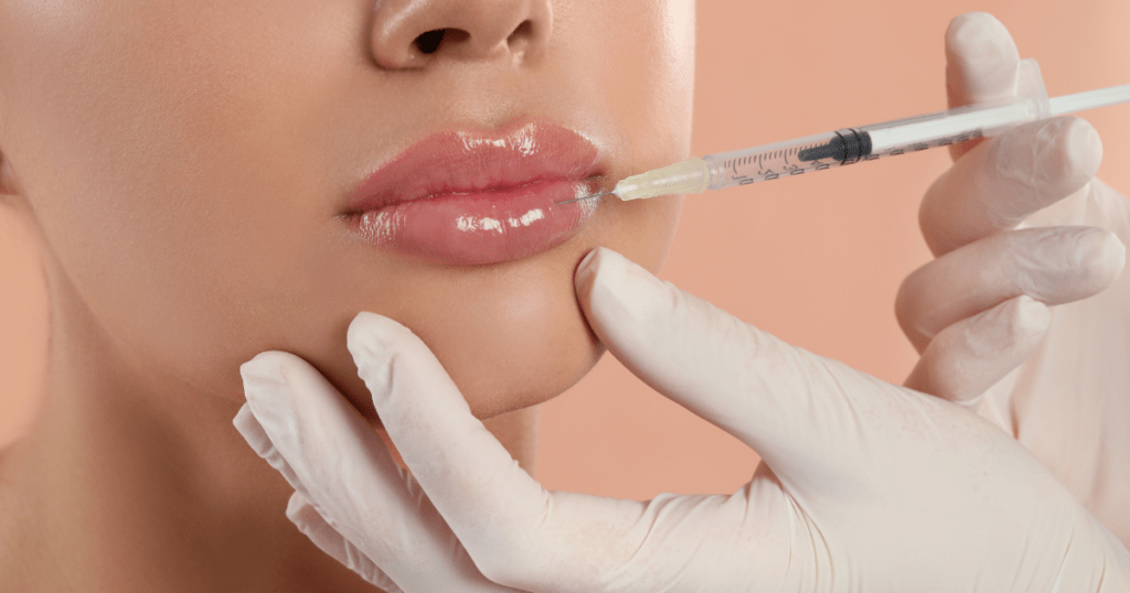 Enhancing Your Pout with Lip Fillers | Anew Laser El Monte, Newport Beach