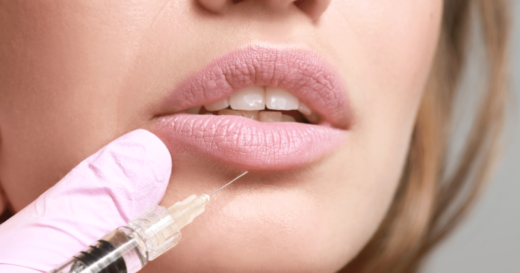 The Lip Fillers Procedure  | Anew Laser El Monte, Newport Beach