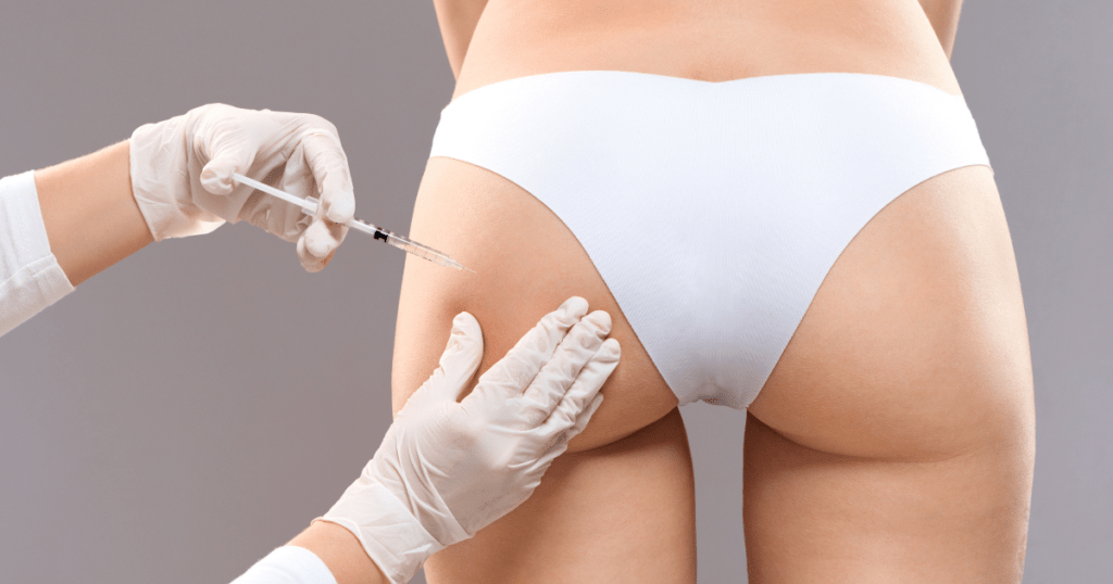 Injection Process for Sculptra Butt Enhancement | Anew Laser MD El Monte and Newport Beach